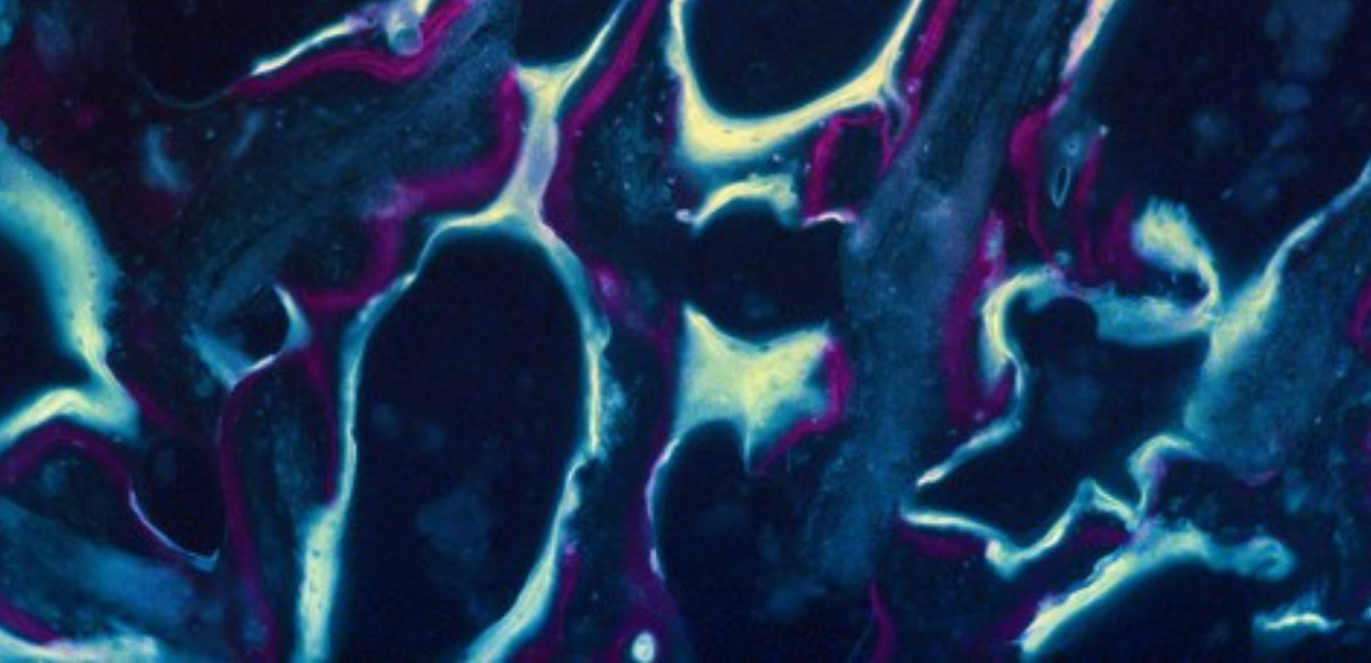 Coloured patterns which show new bone growth under a microscope